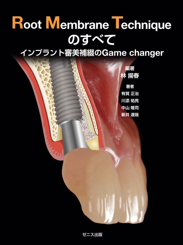 インプラント専門書「Root Membrane Technique のすべて　-インプラント審美補綴のGame changer-」が発刊されました