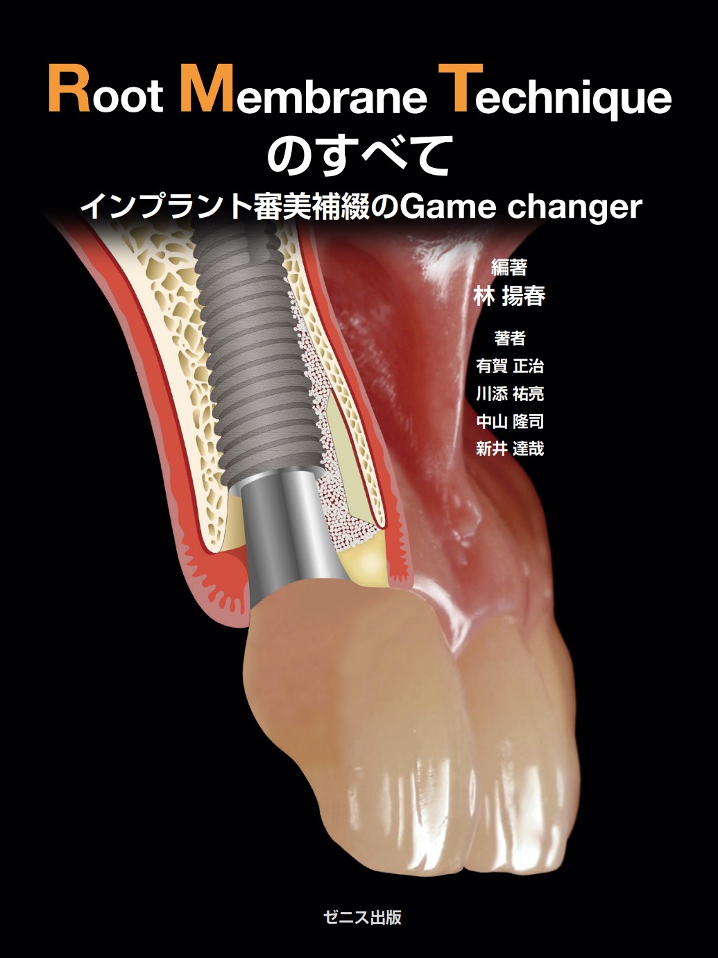 インプラント専門書「Root Membrane Technique のすべて　-インプラント審美補綴のGame changer-」が発刊されました